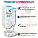 Baby Doppler Fetal aparelho de ultrassom portátil branco e azul para ouvir batimentos cardíacos do feto